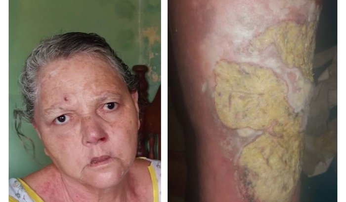 todos em prol pela saúde da Senhora Augusta