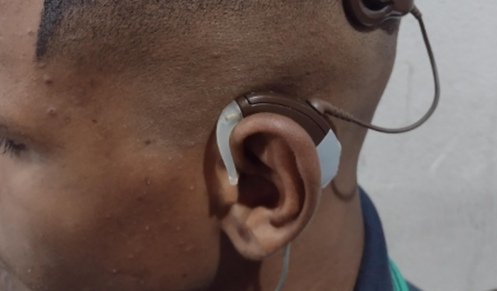 Comprar aparelho auditivo 