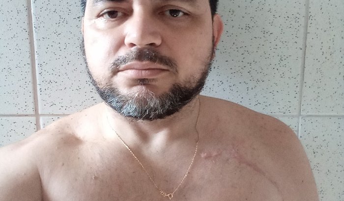Ajuda para recuperação do plexo braquial .