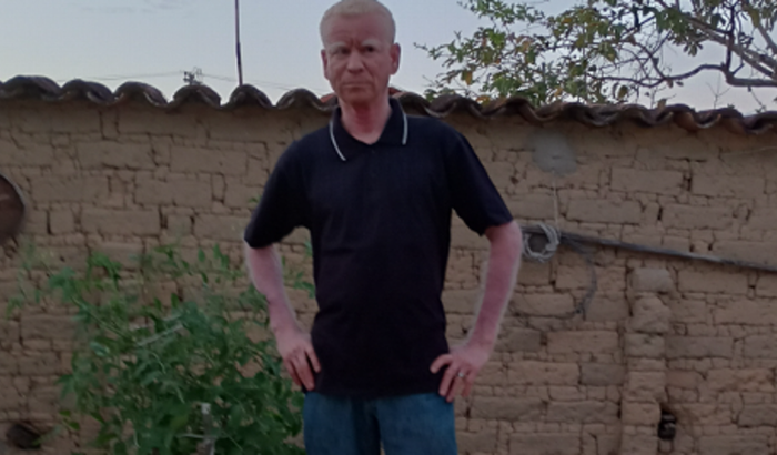 Ajude a Fernando Rodrigues Salomão a fazer a consulta com o oftalmologista oftalmologista e a comprar um óculos bifocal.