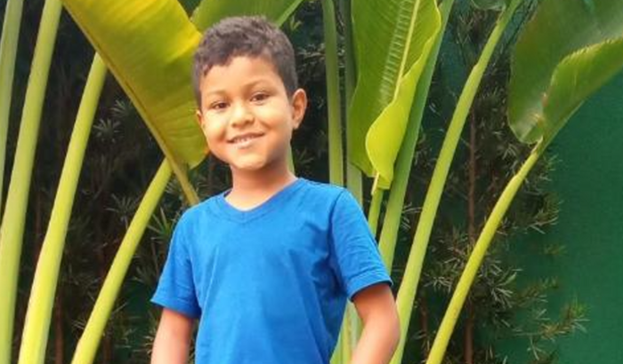 CIRURGIA DE ADENÓIDE