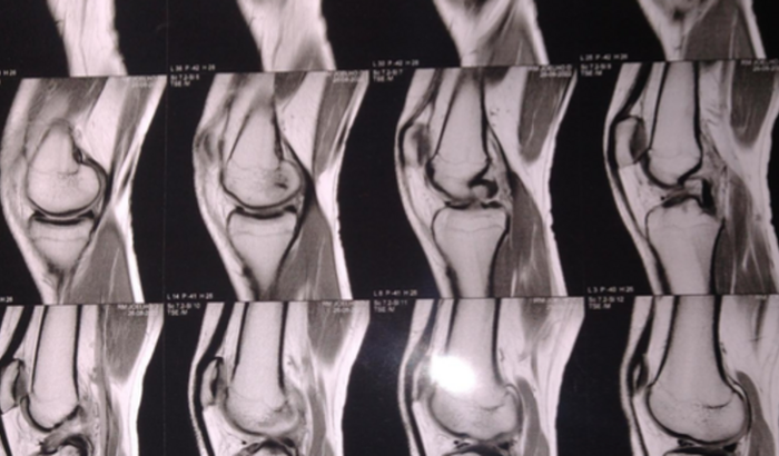 Ajuda para realizar a cirurgia: rompimento do ligamento