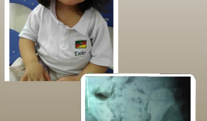 AJUDA PARA A CIRURGIA DA ESTER VIDAL DA CUNHA