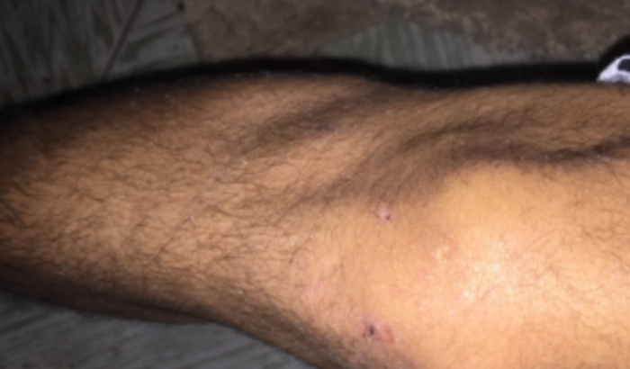 Para me ajudar na ressonância do meu joelho