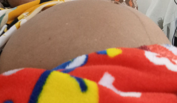 Vakinha para tratamento Raquel