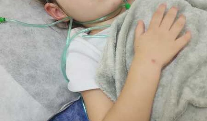 Ajuda pra Yara vencer tumor gravíssimo no tronco cérebral