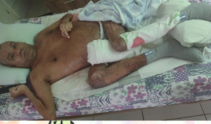 Comprar remédios pa um acamado com paralisia 