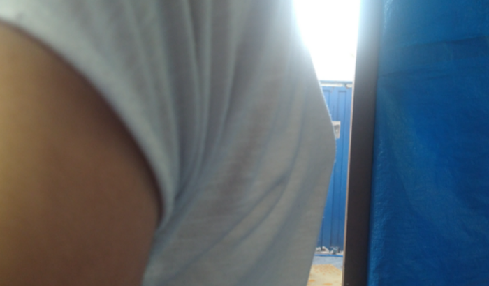 VAKINHA PRA ARRECADAR DINHEIRO PARA CIRURGIA DE COLUNA DA MINHA NETA 