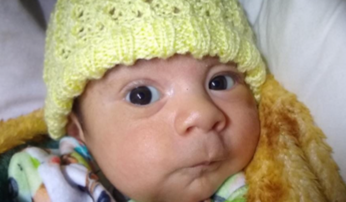 Ajuda cirurgia Tenotomia do Beni