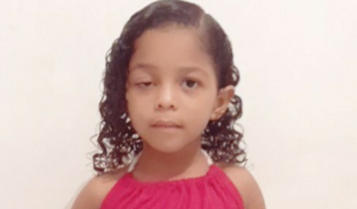 Cirurgia de ptose ( olho direto)