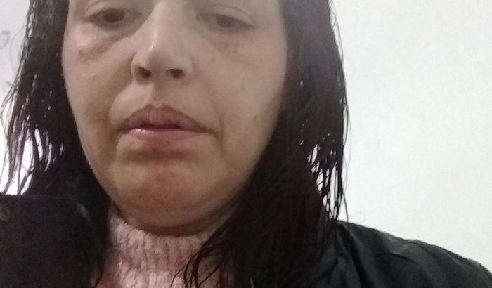 Ajuda de custo com tratamento psiquiátrico e contas atrasadas 