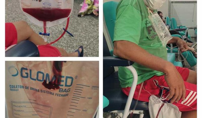 Cirurgia Vesícula e Prostata