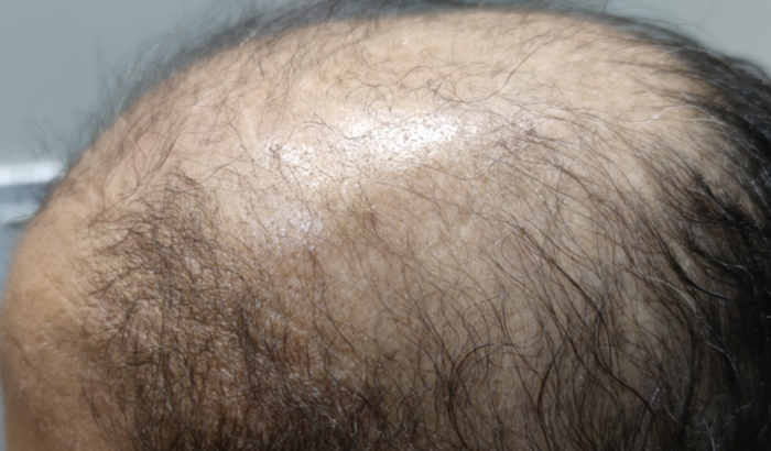 Peruca  e consulta para Eliane 