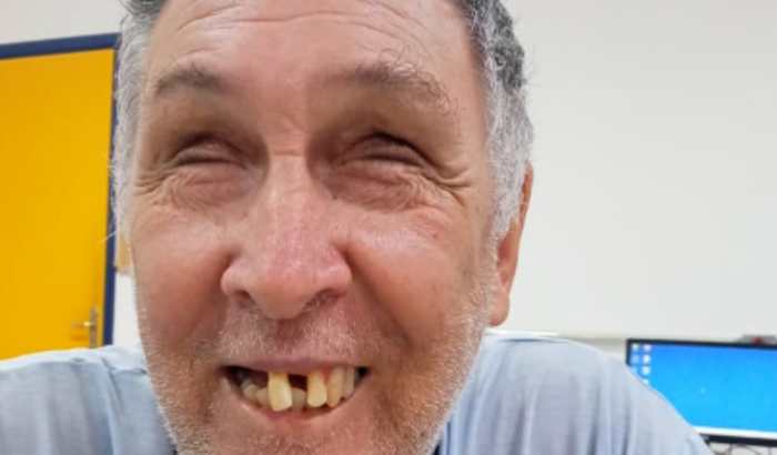 Tratamento Dentário