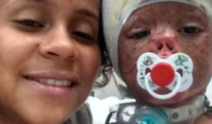 AJUDA URGENTE PARA JOÃO QUE SOBREVIVEU A UM INCÊNDIO