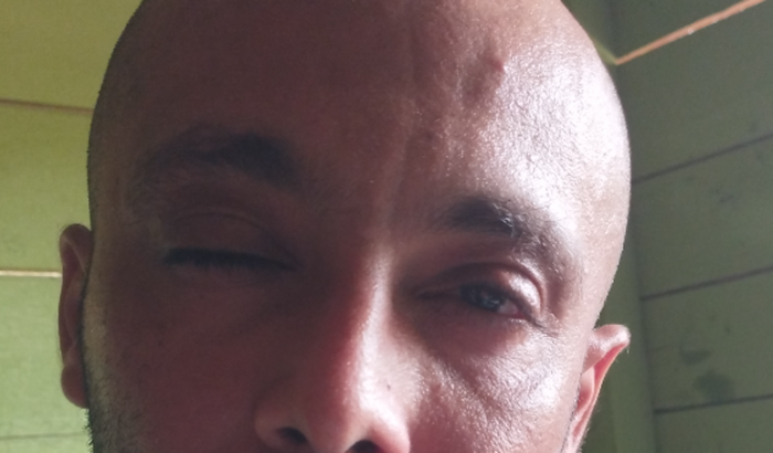 Realizar o sonho de operar a visão do senhor Andrade ele necessita urgente.pix 02448277290