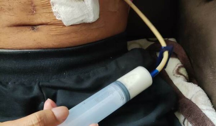 Todos na luta contra o câncer 