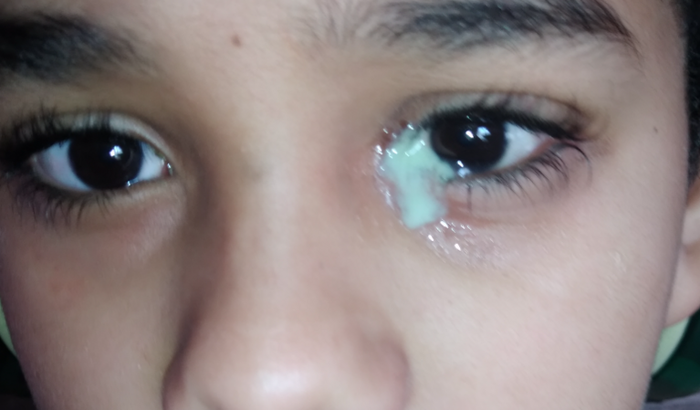 Ajuda para a cirurgia do Gabriel 