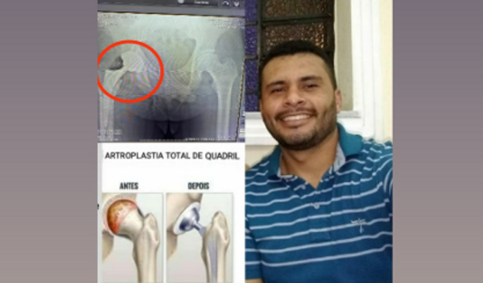 Campanha beneficente para cirurgia do Éder