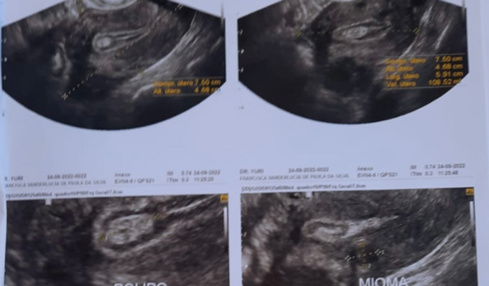 Ajuda para realizar minha cirurgia de Histerectomia total.