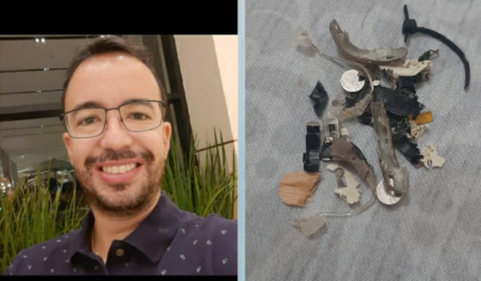 Ajuda para comprar aparelhos auditivos