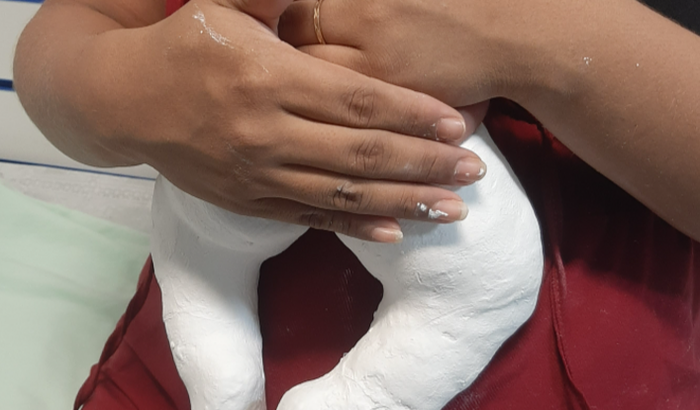 Para pagar o tratamento do pezinho do meu filho que nasceu com os pesinhos tortos