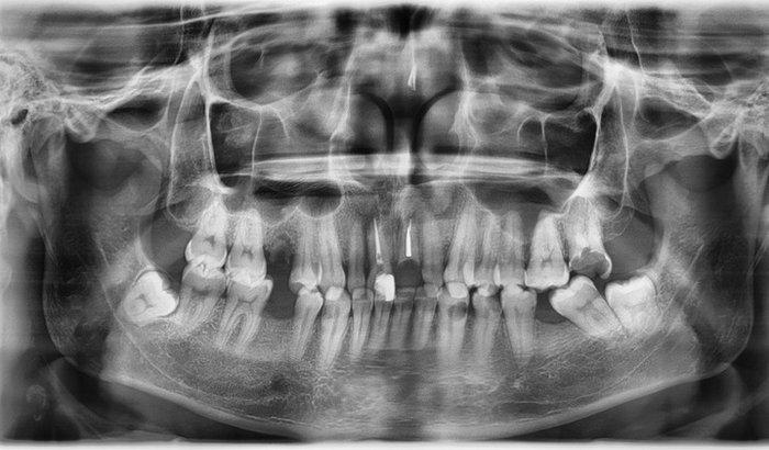 Ajuda para tratamento bucal