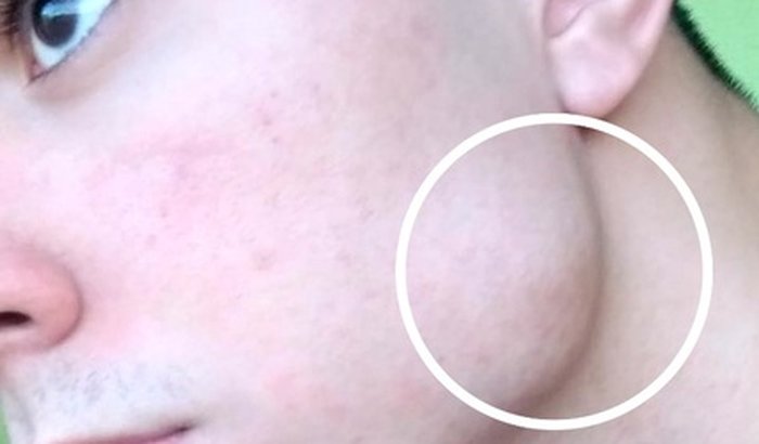 AJUDE A REALIZAR CIRURGIA DO FILIPE 