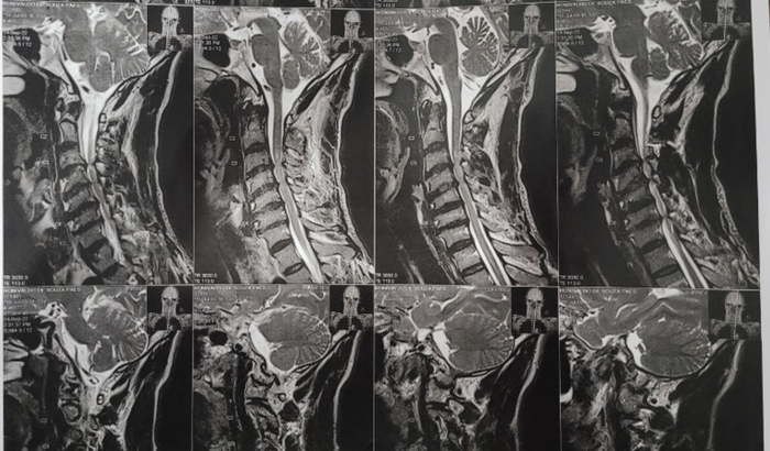Força Roni - Estamos contigo