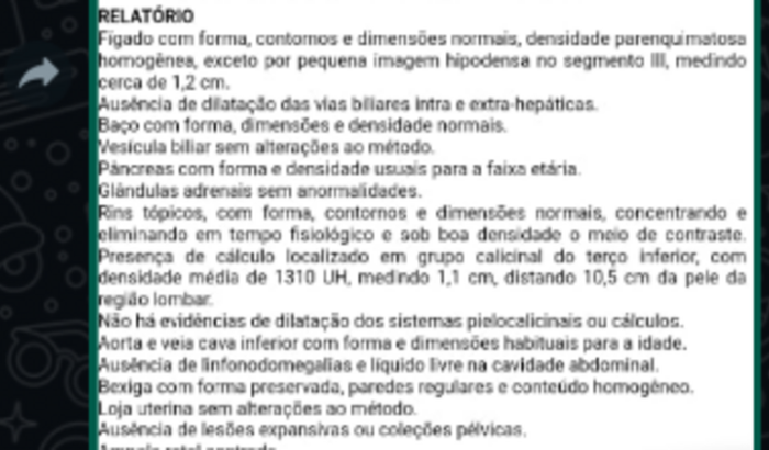 Preciso tirar um cálculo renal estou dois anos na fila do sus,,sofro todos os dias com cólicas renal
