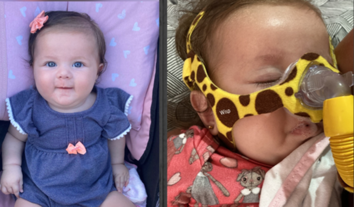 Ajude Alice Jacoboski (AME Tipo 1 Grave )