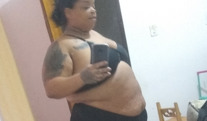 Bariátrica da minha ex 