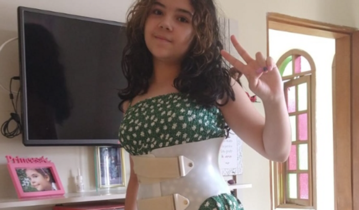 Vakinha colete escoliose da Lica