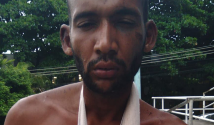 Tratamento do meu irmão que é pac.psiquiátrico e dep.químico.