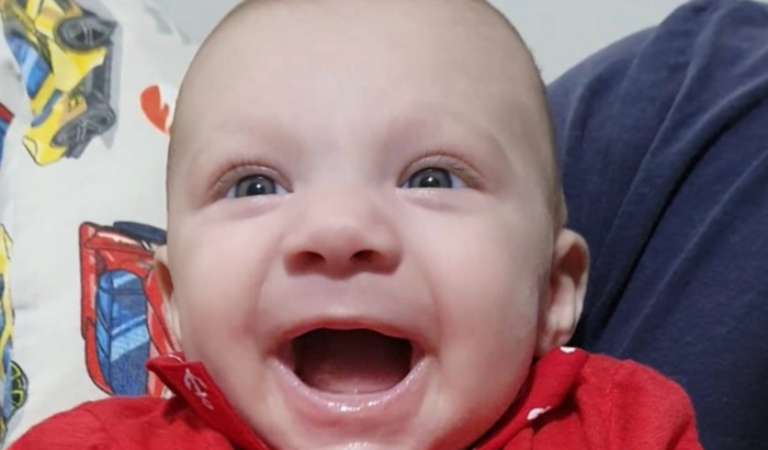 Tratamento para Síndrome de West do Arthurzinho