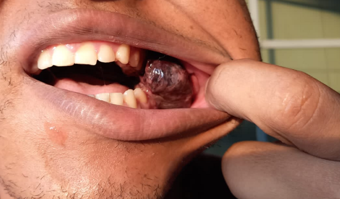 Ajuda para Tratamento Michael 