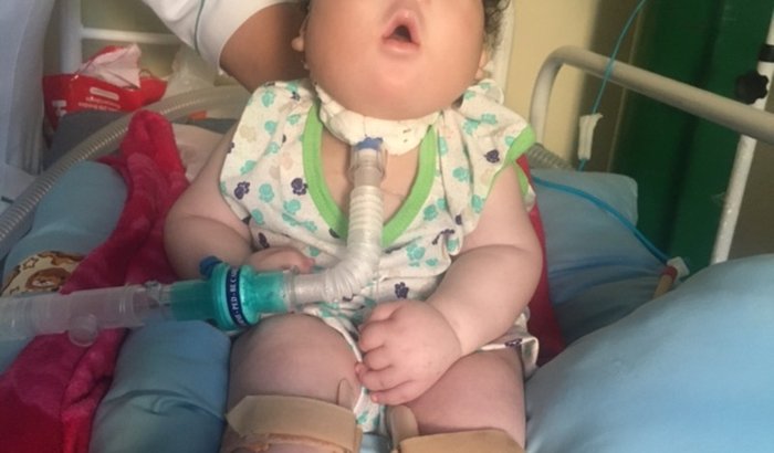 Ajuda para o tratamento do Noah ravi 