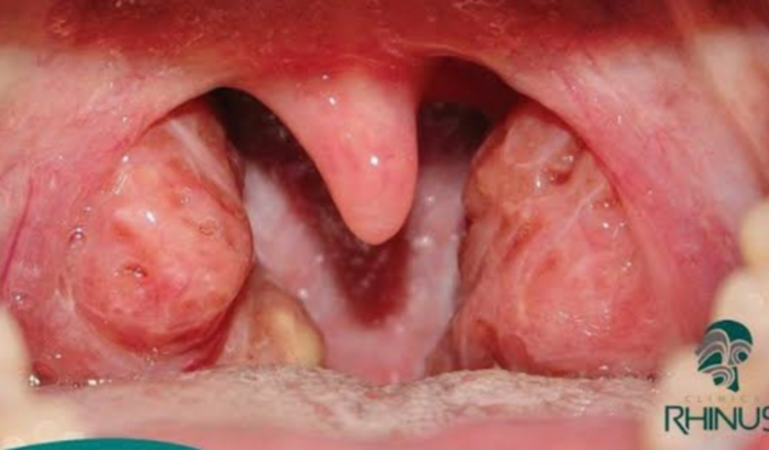 Me ajuda a fazer minha Cirurgia