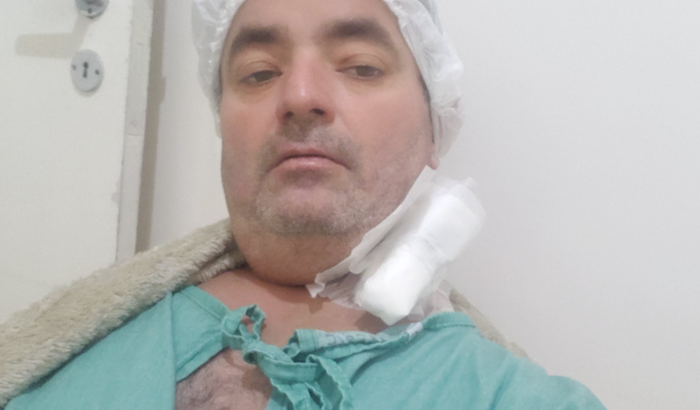 Tratamento Rodriguinho