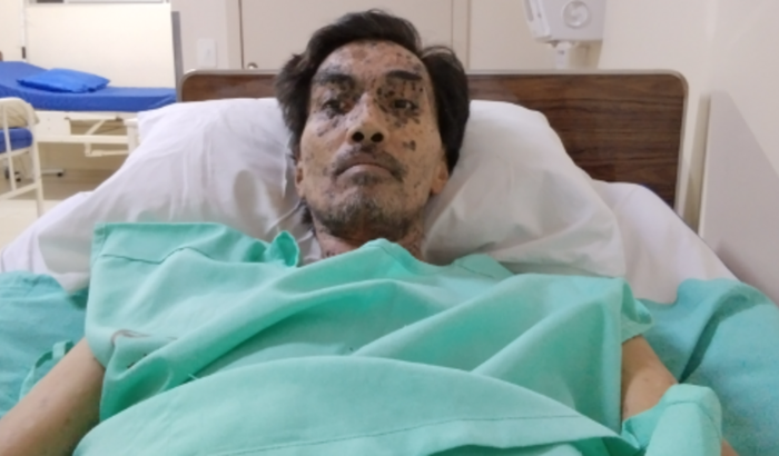 Ajuda despesas medicas e na recuperação da coluna lombar