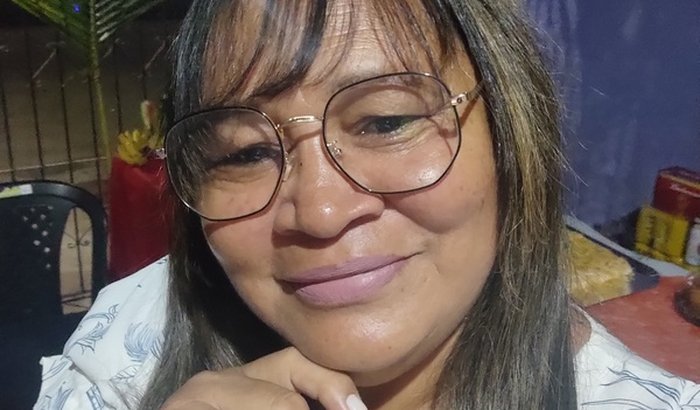 Tratamento médico espondilite anquilosante na coluna, artrite reumatóide, osteoartrite , artrite e exames do coração