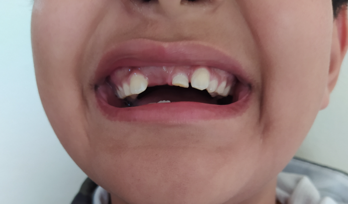 Ajude o iarley a voltar a sorrir !