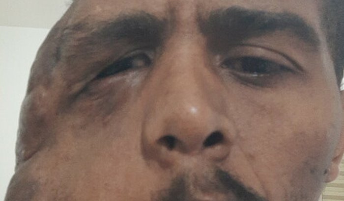 Realizar tratamento médico para fazer uma cirurgia num rosto.