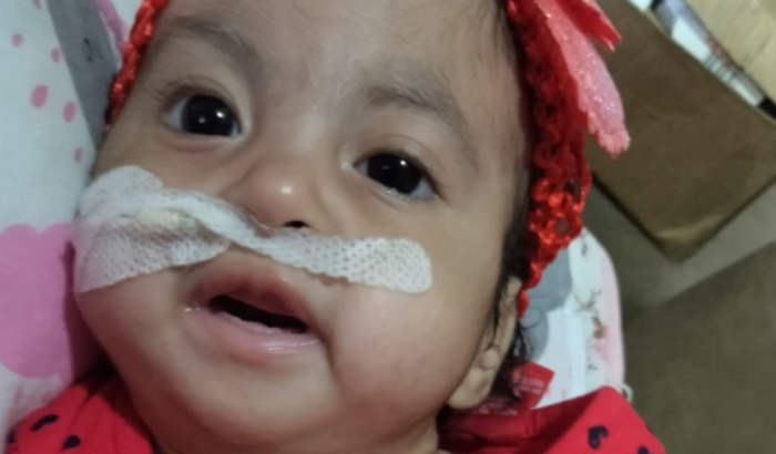 Ajuda para fazer um enxame de broncoscopia para minha filha Laura Sophia