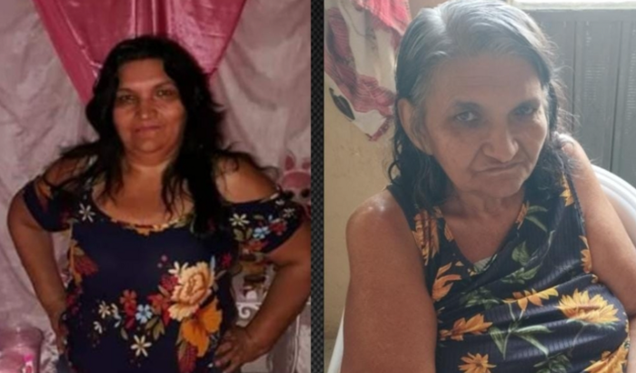 Ajuda para tratamento de osteossarcoma (CÂNCER NOS OSSOS)