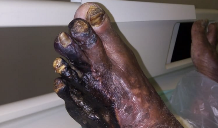 Cirurgia do meu avô 