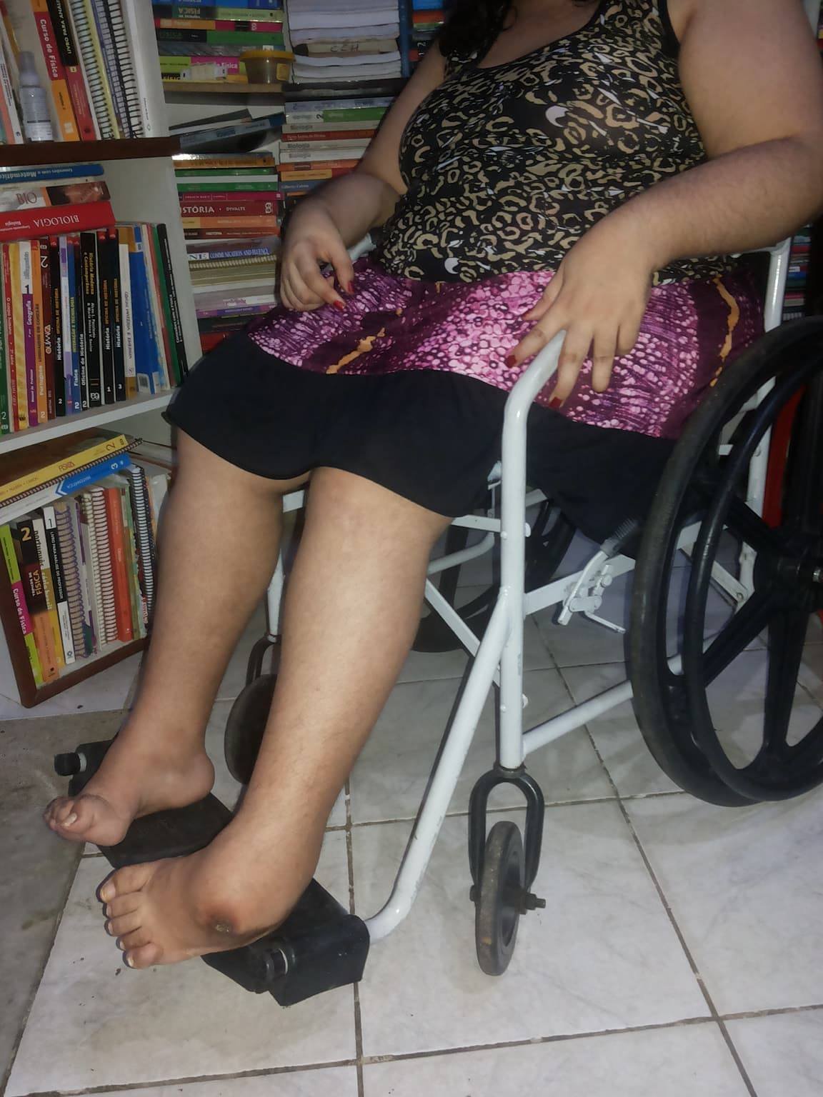 imagem da vaquinha Cirurgia de Adriane Mendonça