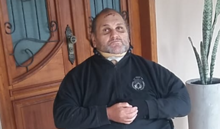 AJUDE O GILSON MÁRCIO A RECUPERAR OS MOVIMENTOS