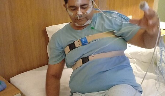 Tratamento de Bruno (Doença de corpus de Lewy, parkinsonismo)