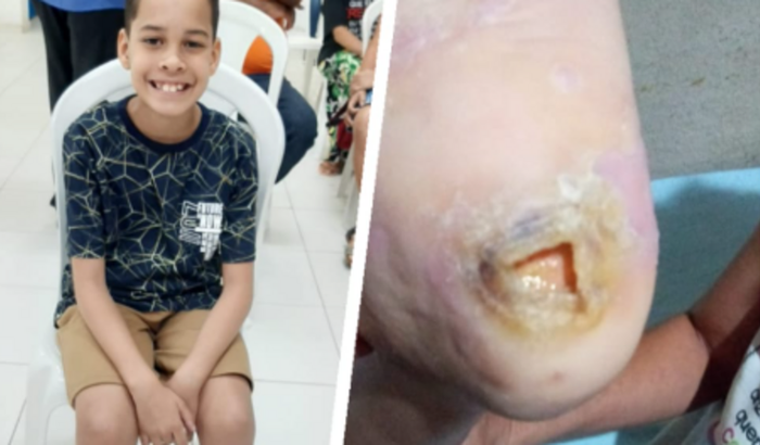 Tratamento do Daniel 